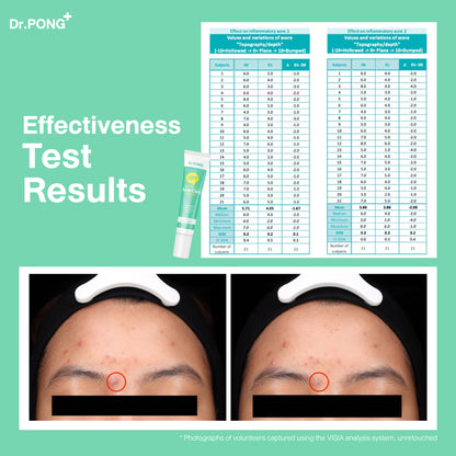 Dr.PONG 28H WHITENING DRONE ACNE CLEAR SPOT GEL