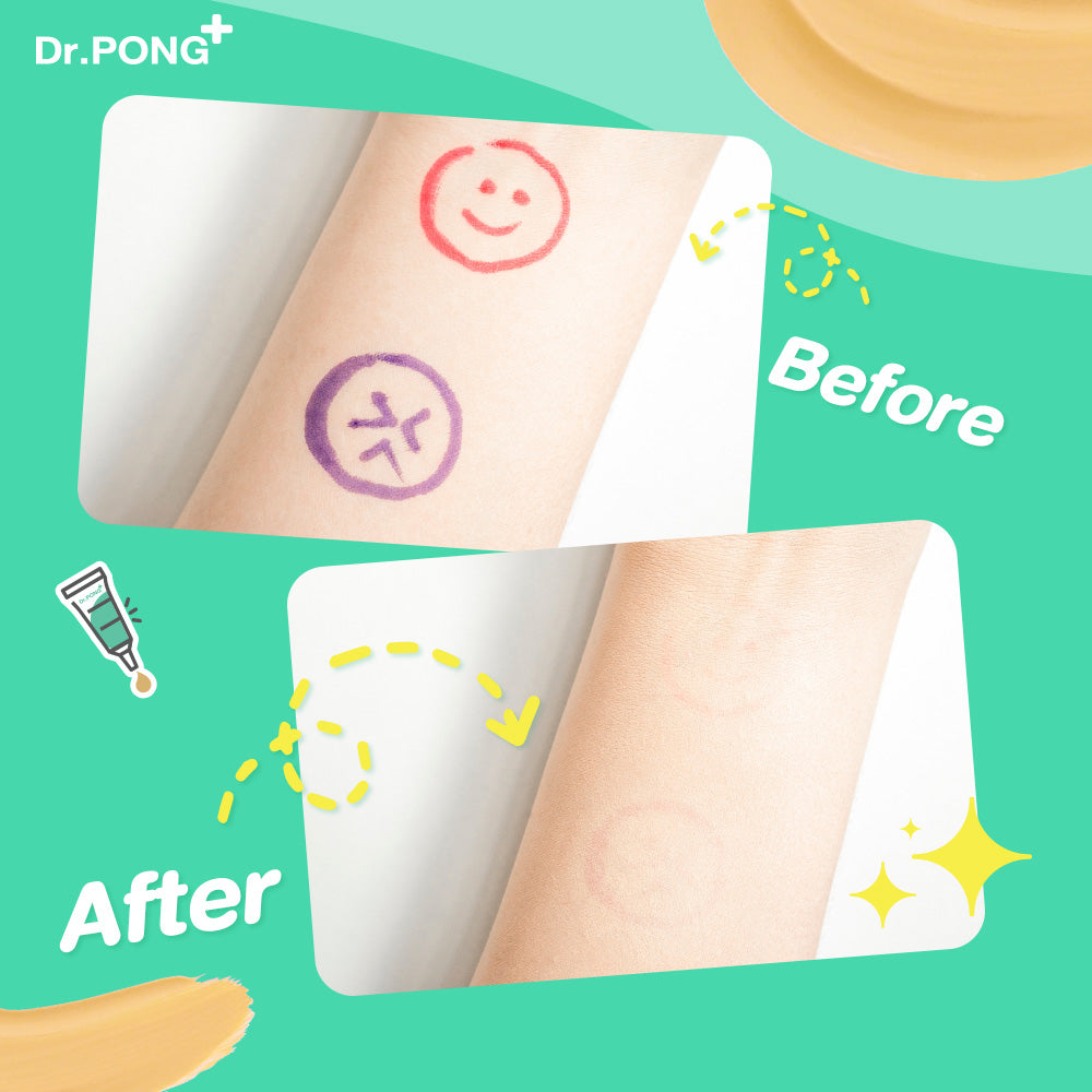 Dr.PONG 101 ACNE CLEAR CONCEALER