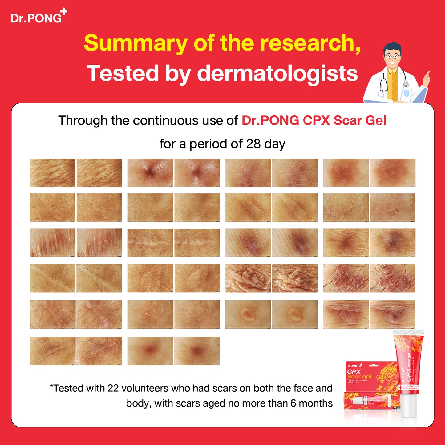 Dr.PONG CPX SCAR GEL