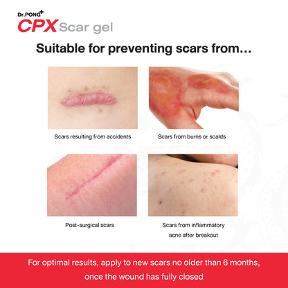 Dr.PONG CPX SCAR GEL