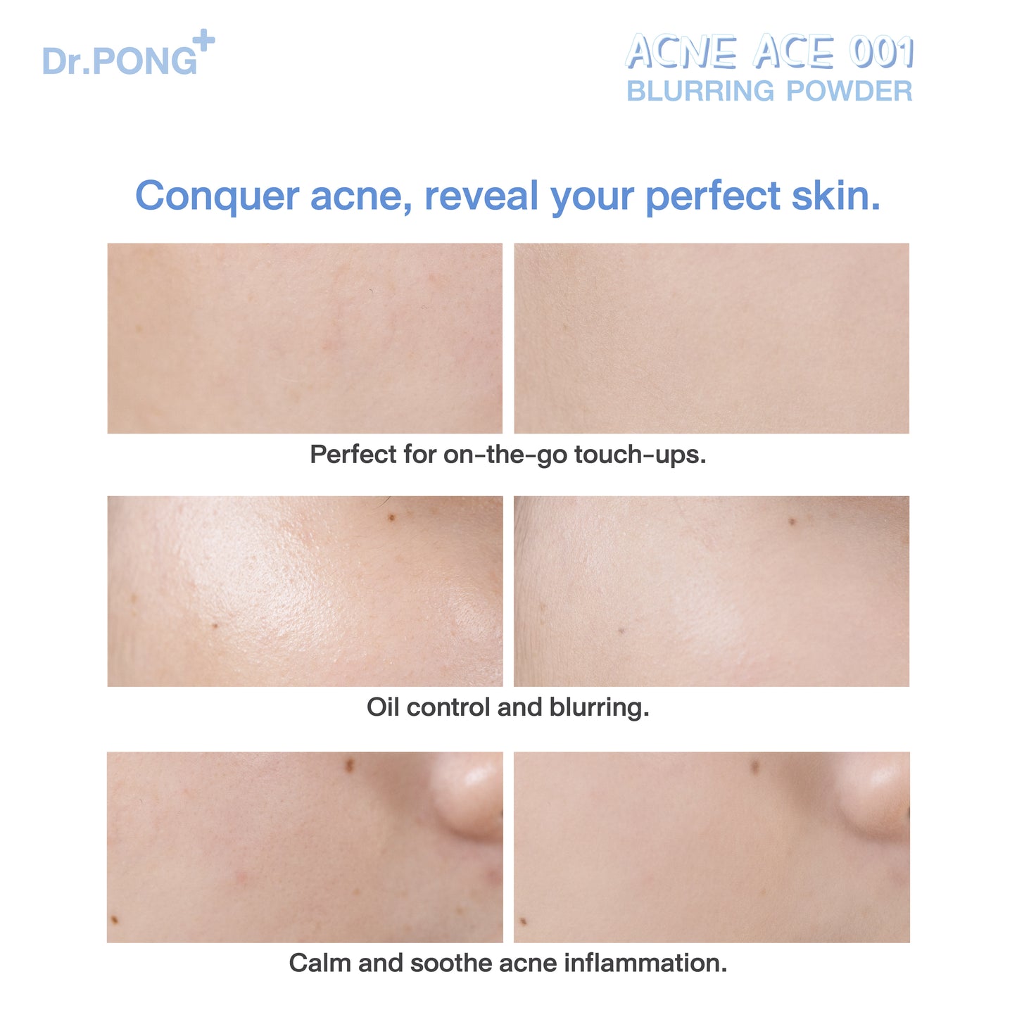 Dr.PONG ACNE ACE 001 BLURRING POWDER