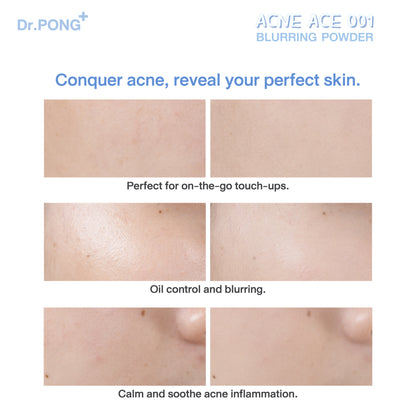 Dr.PONG ACNE ACE 001 BLURRING POWDER