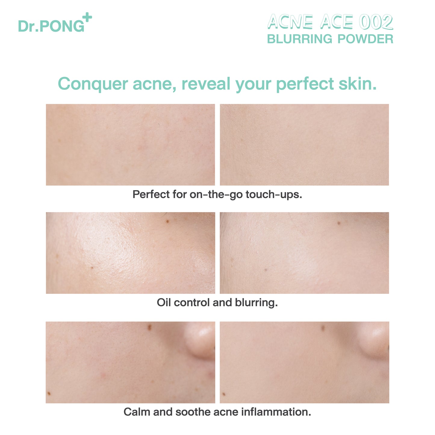 Dr.PONG ACNE ACE 002 BLURRING POWDER