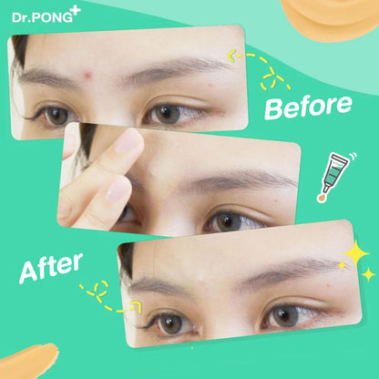 Dr.PONG 101 ACNE CLEAR CONCEALER